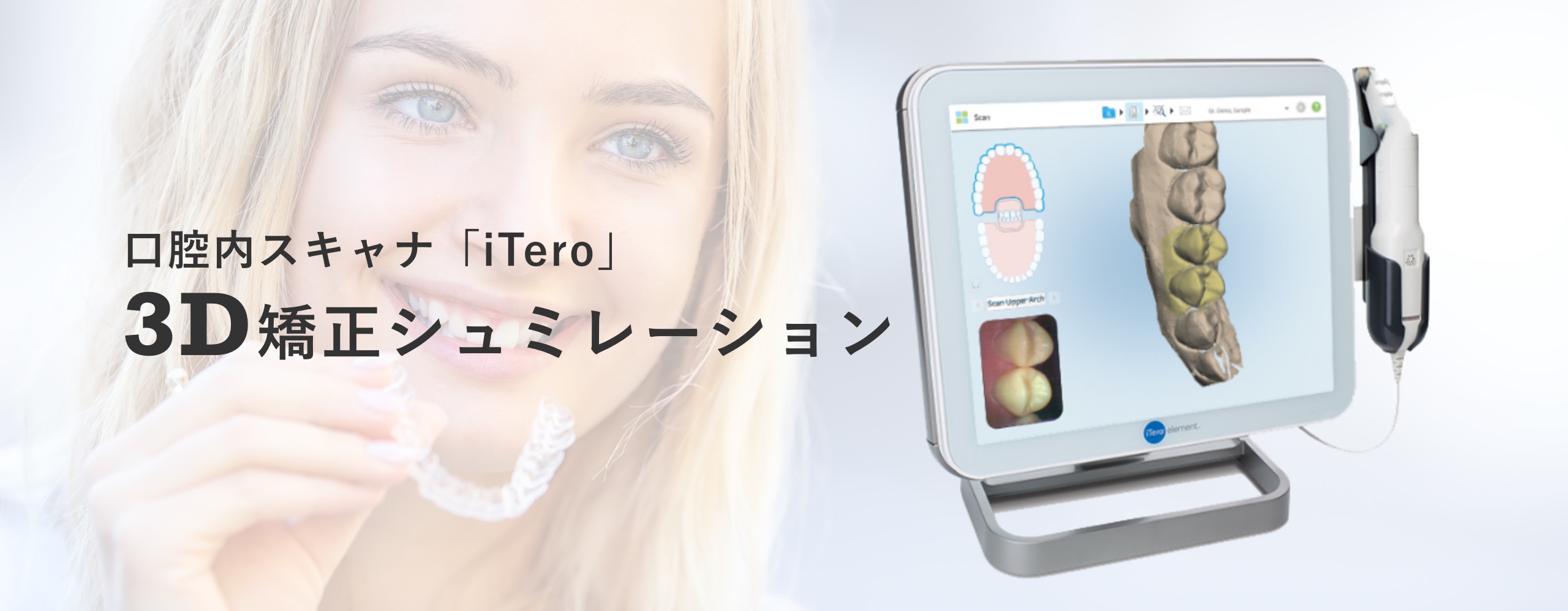 口腔内スキャナ「iTero」 3D矯正シュミレーション