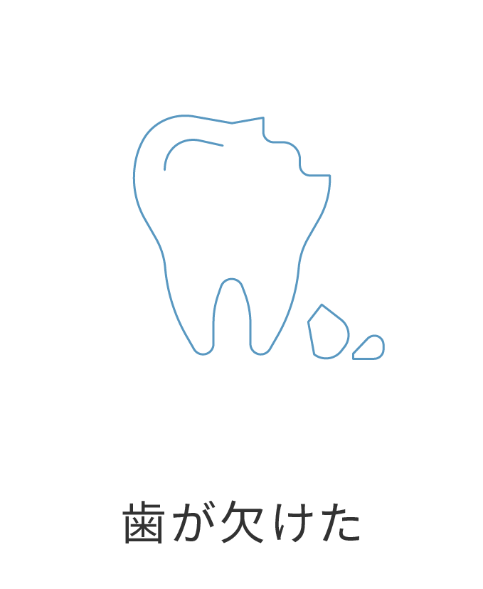 受け口