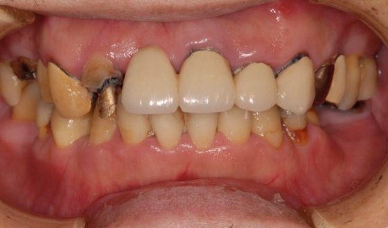 各分野の専門ドクターによる「全顎治療」の症例 - 初台の歯医者なら