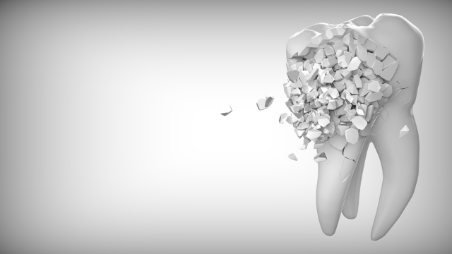 治療中の生活への影響｜仮歯・仕事・食事はどうなる？