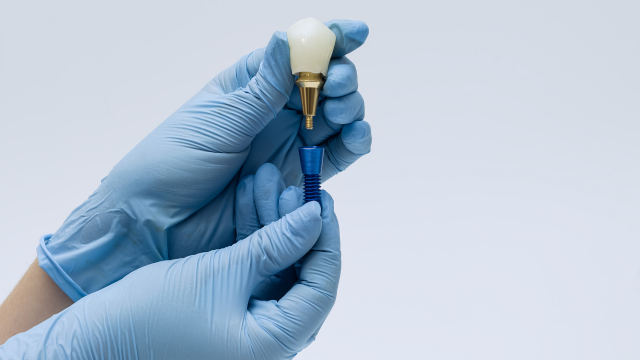 インプラント治療期間の平均は3〜12か月